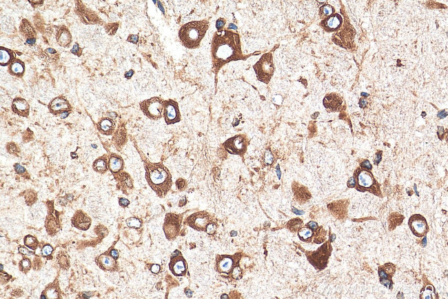 RPL9 Antibody in Immunohistochemistry (Paraffin) (IHC (P))