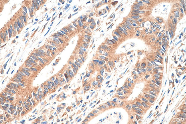 RPLP0 Antibody in Immunohistochemistry (Paraffin) (IHC (P))