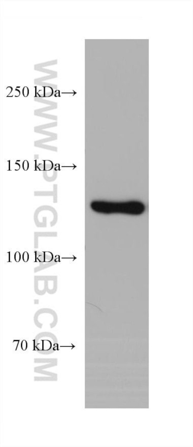 RFX1 Antibody in Western Blot (WB)