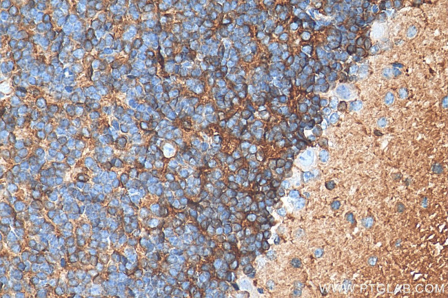 FXYD6 Antibody in Immunohistochemistry (Paraffin) (IHC (P))