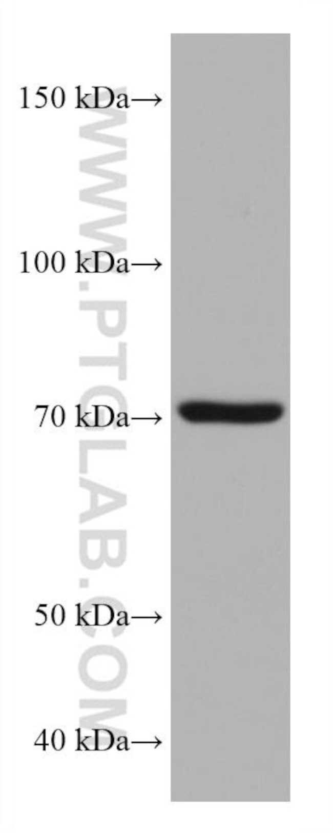 NSF Antibody in Western Blot (WB)
