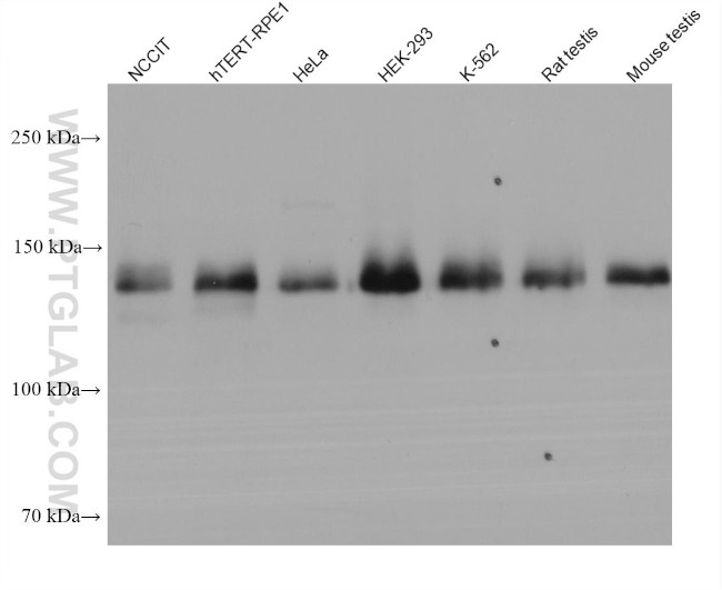 NBR1 Antibody in Western Blot (WB)