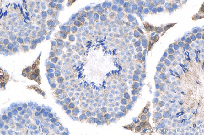 NDUFS3 Antibody in Immunohistochemistry (Paraffin) (IHC (P))