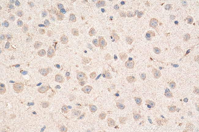 FTL Antibody in Immunohistochemistry (Paraffin) (IHC (P))