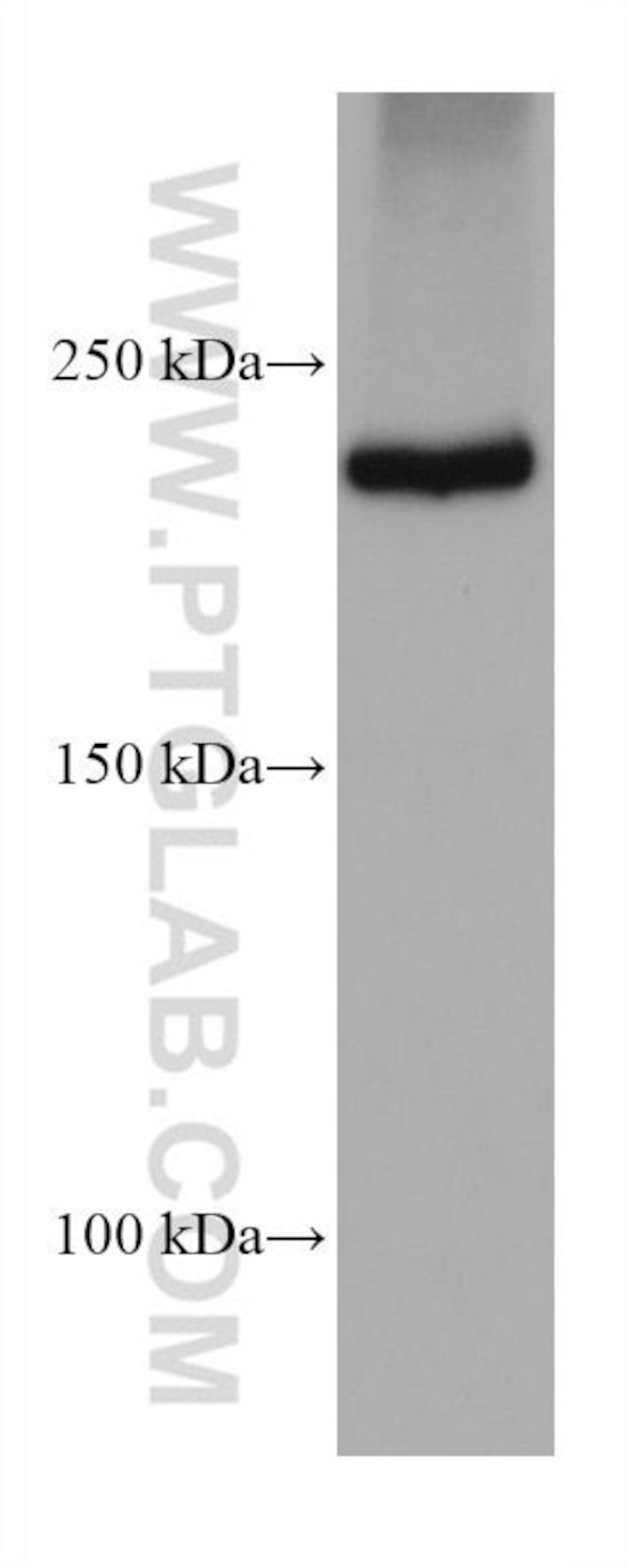 PTPRF Antibody in Western Blot (WB)