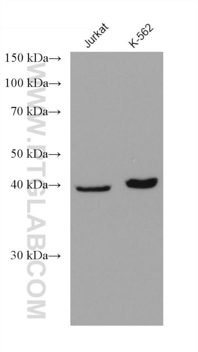 Septin 5 Antibody in Western Blot (WB)