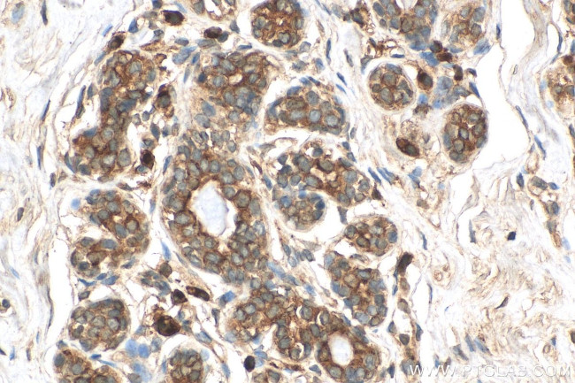 TPD52L2 Antibody in Immunohistochemistry (Paraffin) (IHC (P))