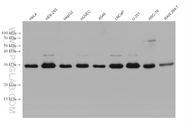 RAB12 Antibody in Western Blot (WB)