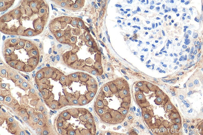 DPEP1 Antibody in Immunohistochemistry (Paraffin) (IHC (P))