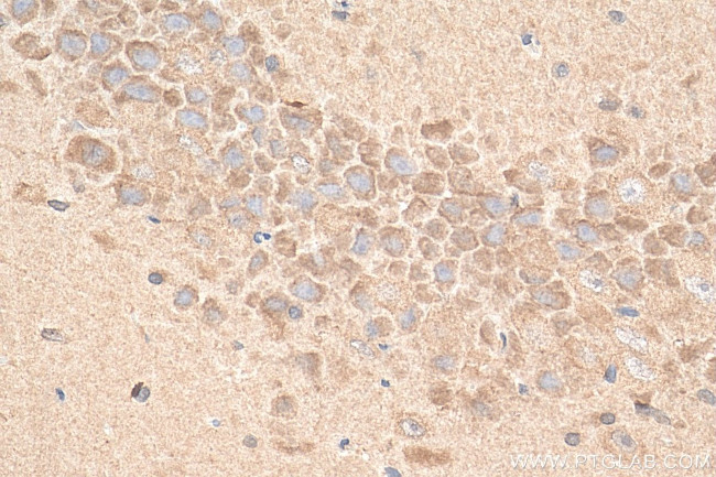 GDAP1 Antibody in Immunohistochemistry (Paraffin) (IHC (P))