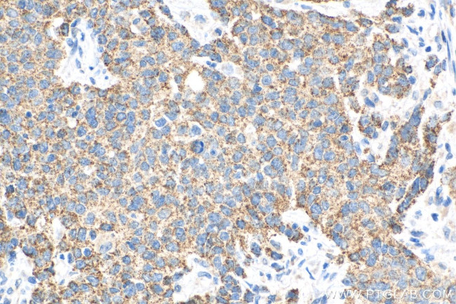 FBXW11 Antibody in Immunohistochemistry (Paraffin) (IHC (P))