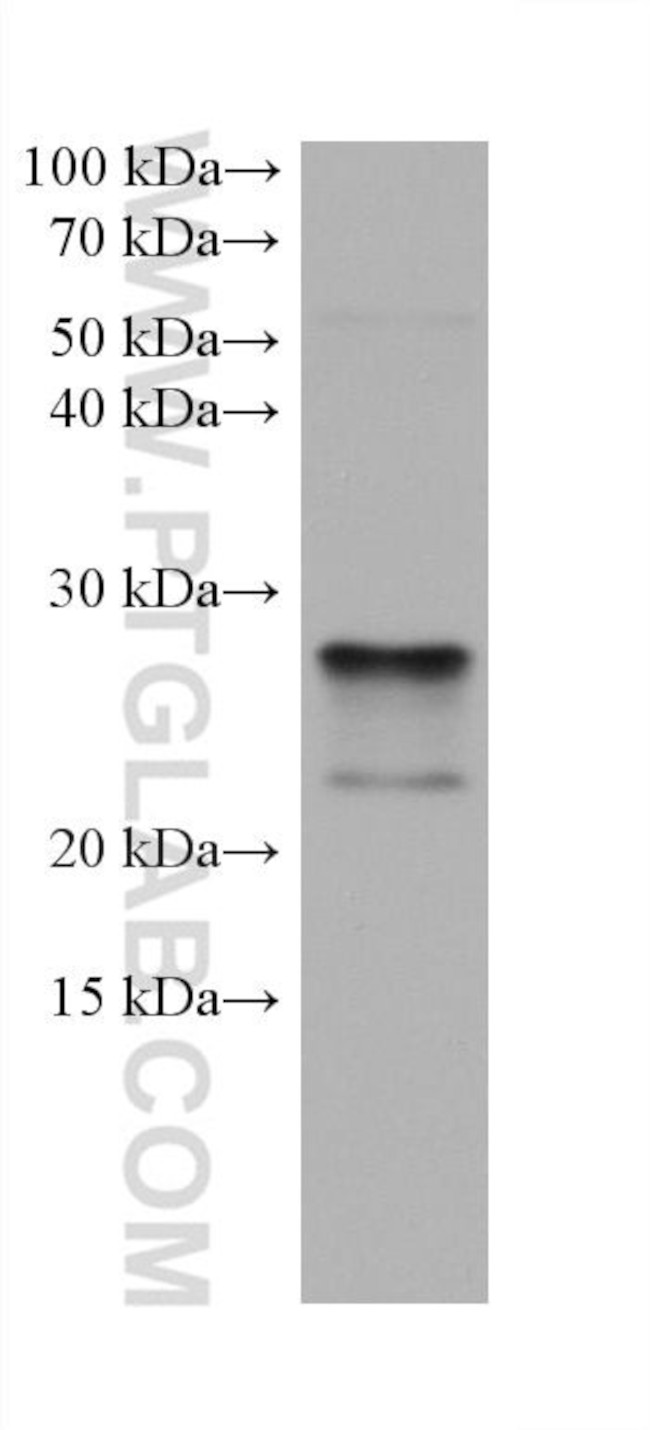BNIP3 Antibody in Western Blot (WB)