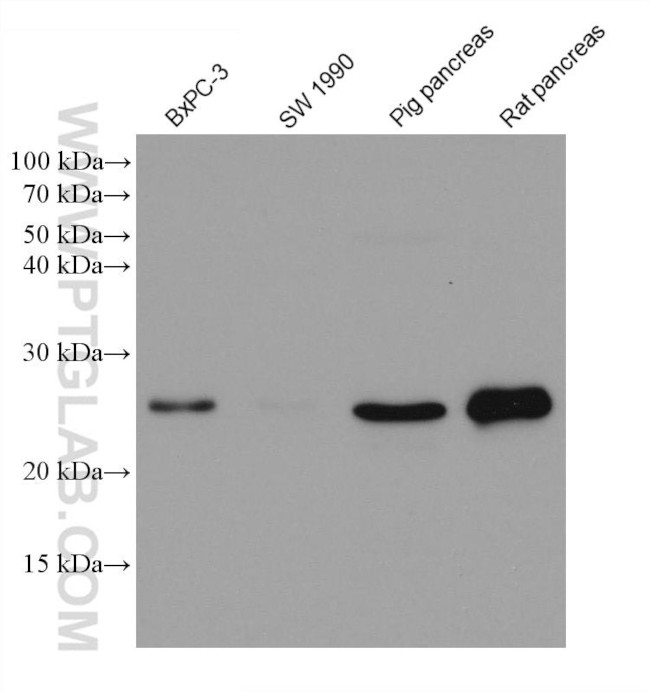 MIST1 Antibody in Western Blot (WB)