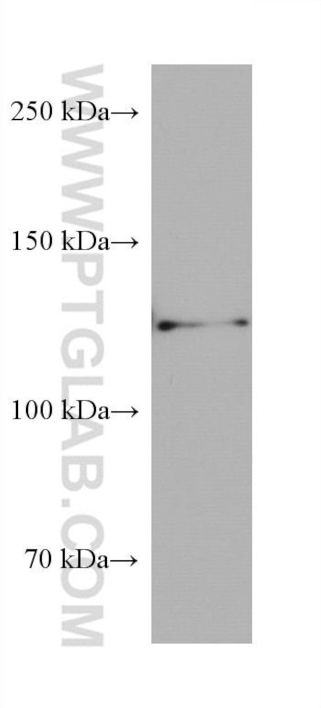 AXIN1 Antibody in Western Blot (WB)