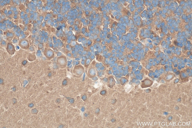 PACSIN1 Antibody in Immunohistochemistry (Paraffin) (IHC (P))