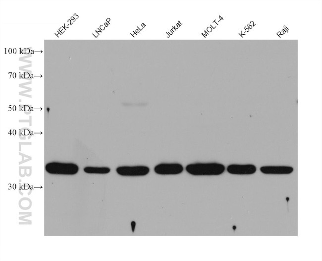 BNIP3L Antibody in Western Blot (WB)