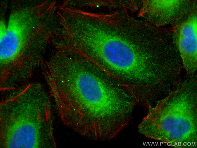 REEP5 Antibody in Immunocytochemistry (ICC/IF)