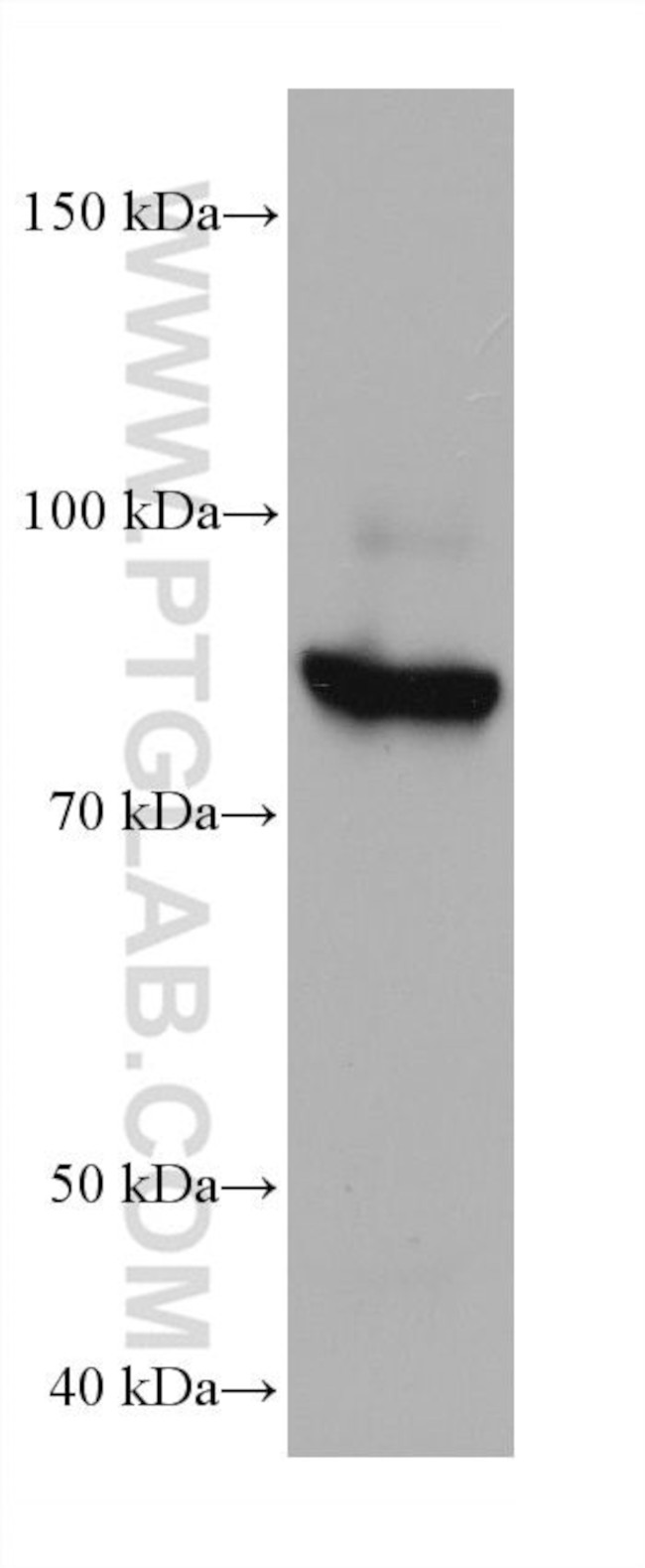 MAN1B1 Antibody in Western Blot (WB)
