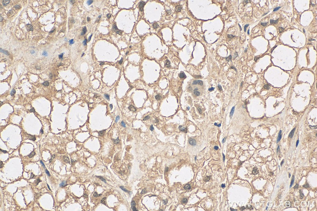 RAP1A Antibody in Immunohistochemistry (Paraffin) (IHC (P))