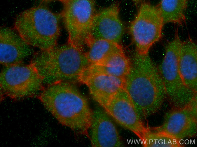 RBP5 Antibody in Immunocytochemistry (ICC/IF)