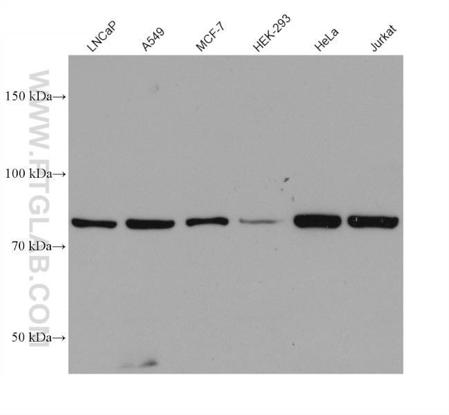 PFKP Antibody in Western Blot (WB)