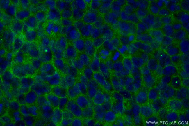 TACSTD2/TROP2 Antibody in Immunocytochemistry (ICC/IF)