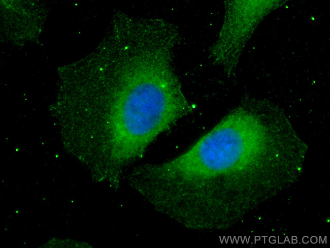 HBS1L Antibody in Immunocytochemistry (ICC/IF)