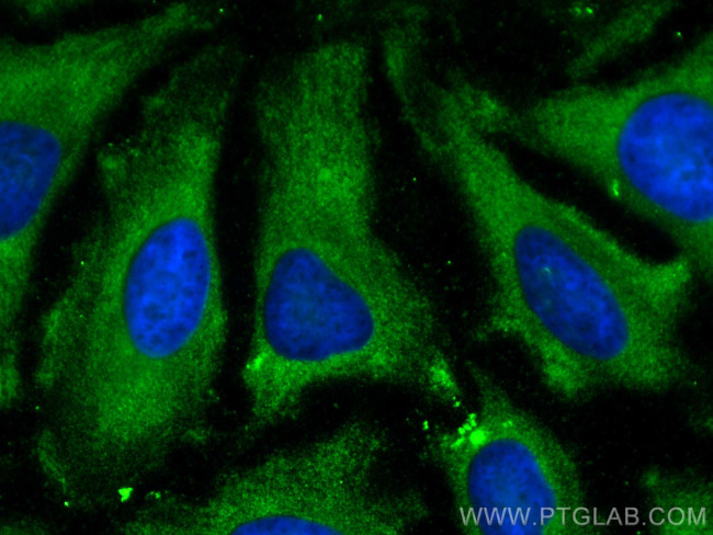 ENO3 Antibody in Immunocytochemistry (ICC/IF)