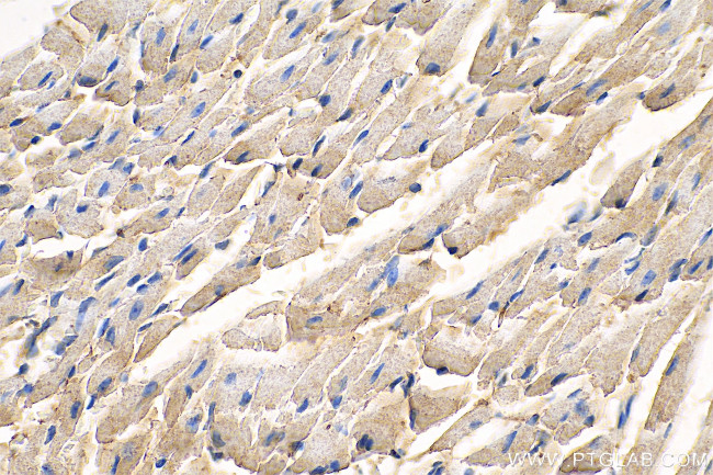 NDUFV2 Antibody in Immunohistochemistry (Paraffin) (IHC (P))