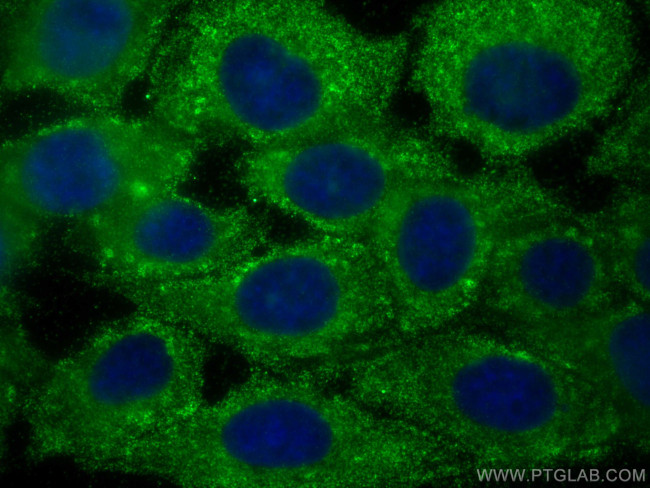AIDA Antibody in Immunocytochemistry (ICC/IF)