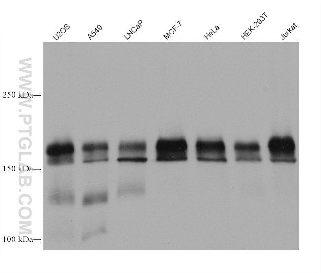 ERBB2IP Antibody in Western Blot (WB)