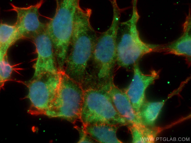 CACYBP Antibody in Immunocytochemistry (ICC/IF)