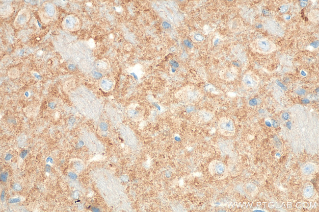 SYNGR1 Antibody in Immunohistochemistry (Paraffin) (IHC (P))
