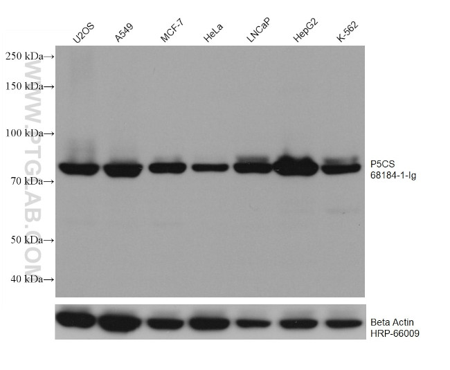 P5CS Antibody in Western Blot (WB)