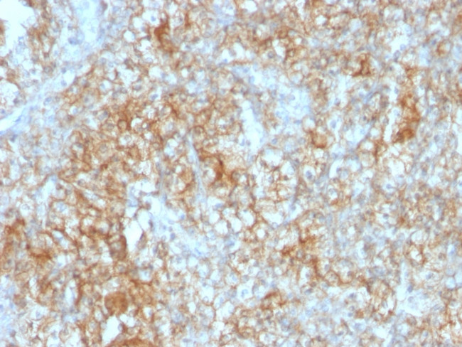 CD147/EMMPRIN/Neurothelin Antibody in Immunohistochemistry (Paraffin) (IHC (P))