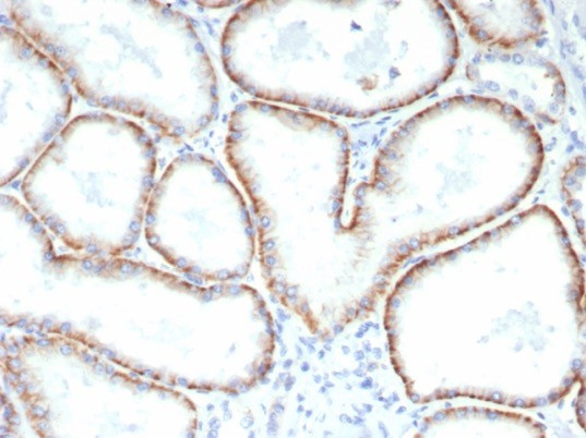 CD147/EMMPRIN/Neurothelin Antibody in Immunohistochemistry (Paraffin) (IHC (P))