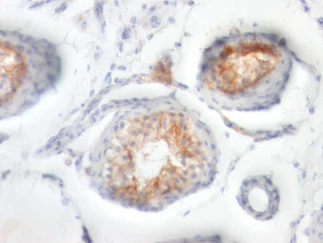 CD147/EMMPRIN/Neurothelin Antibody in Immunohistochemistry (Paraffin) (IHC (P))