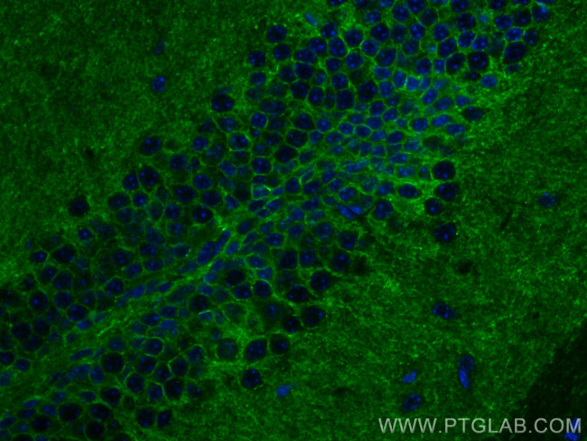 NCAM2 Antibody in Immunohistochemistry (PFA fixed) (IHC (PFA))