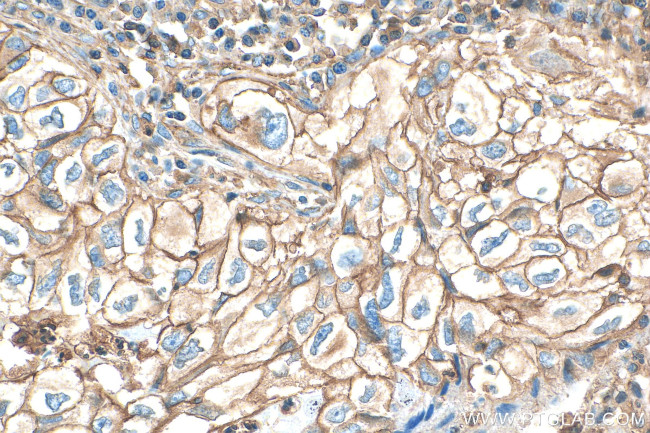 SIRP Beta 1 Antibody in Immunohistochemistry (Paraffin) (IHC (P))