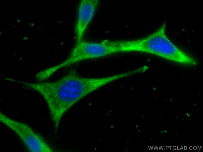 CCT2 Antibody in Immunocytochemistry (ICC/IF)
