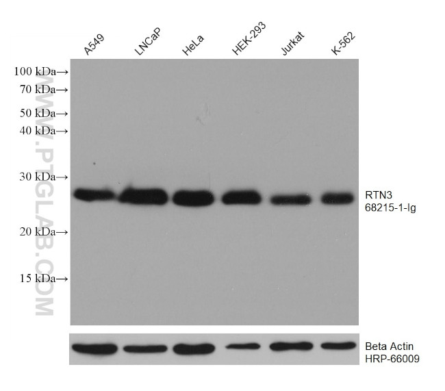 RTN3 Antibody in Western Blot (WB)