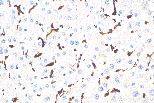 CD163 Antibody in Immunohistochemistry (Paraffin) (IHC (P))
