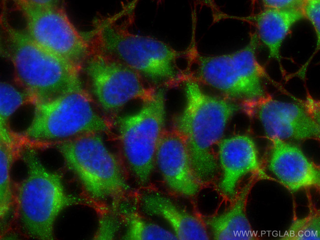 ATP6V1B1 Antibody in Immunocytochemistry (ICC/IF)