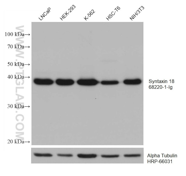 Syntaxin 18 Antibody in Western Blot (WB)