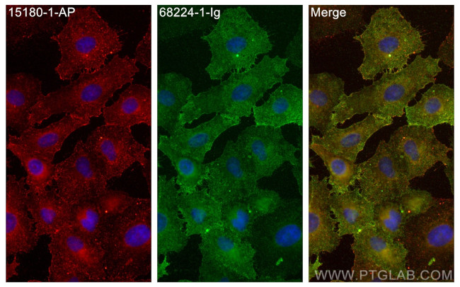 CA12 Antibody in Immunocytochemistry (ICC/IF)