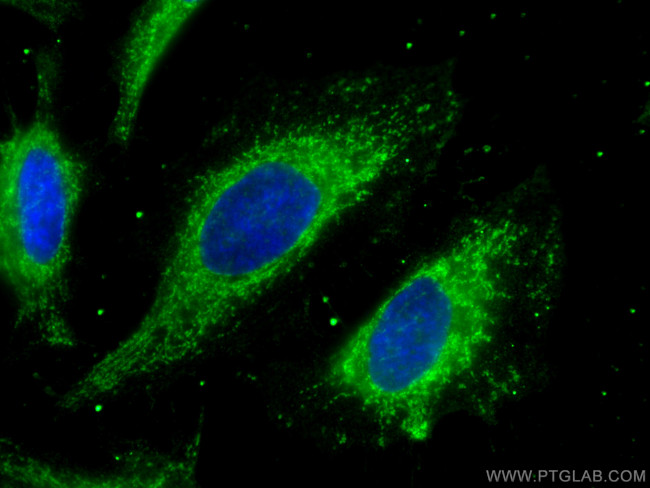 PDHB Antibody in Immunocytochemistry (ICC/IF)