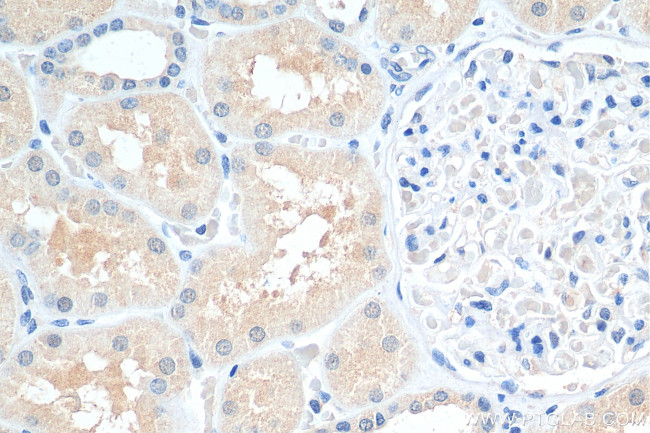 SNX15 Antibody in Immunohistochemistry (Paraffin) (IHC (P))