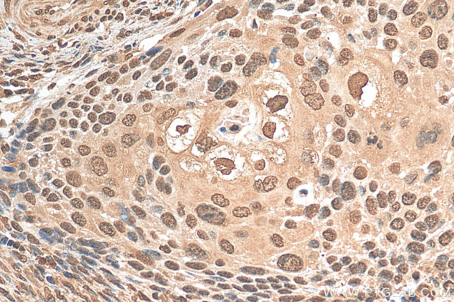 PSMA2 Antibody in Immunohistochemistry (Paraffin) (IHC (P))