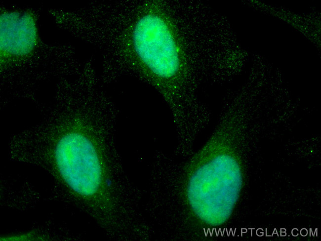 SUPT16H Antibody in Immunocytochemistry (ICC/IF)
