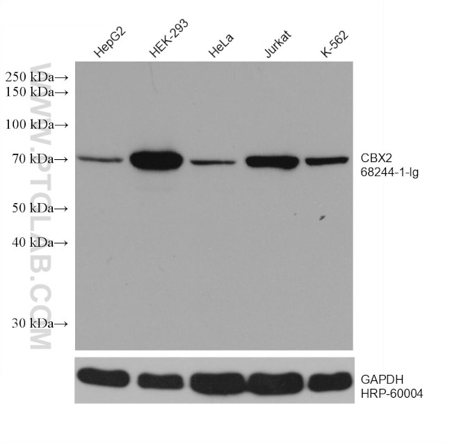 CBX2 Antibody in Western Blot (WB)